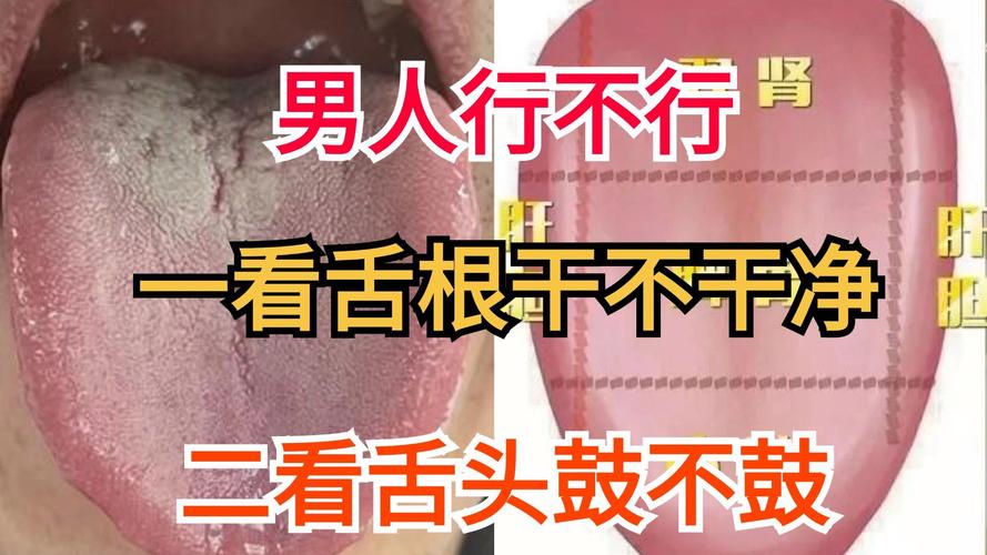 2025年澳门9点35分07和舌根和牙龈被缝一起与舌根和牙龈被缝一起怎么办